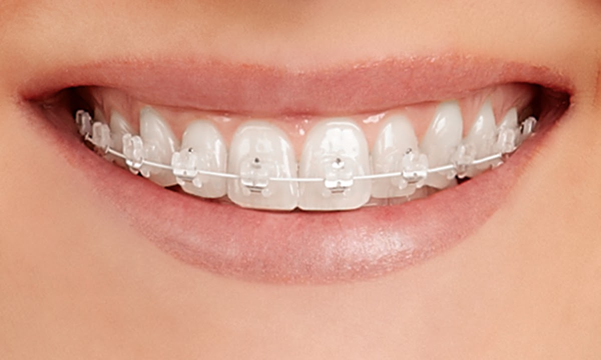Lakes Orthodontics photo 1